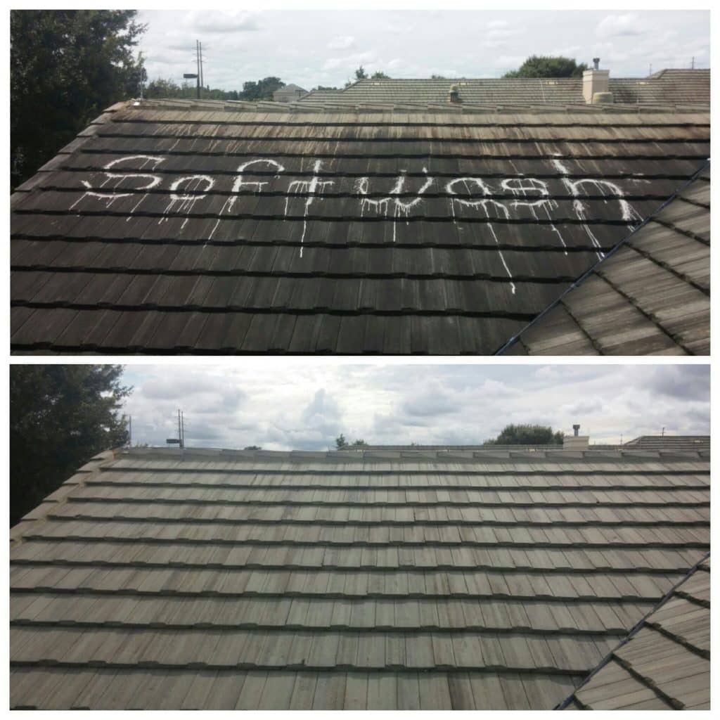 shingles